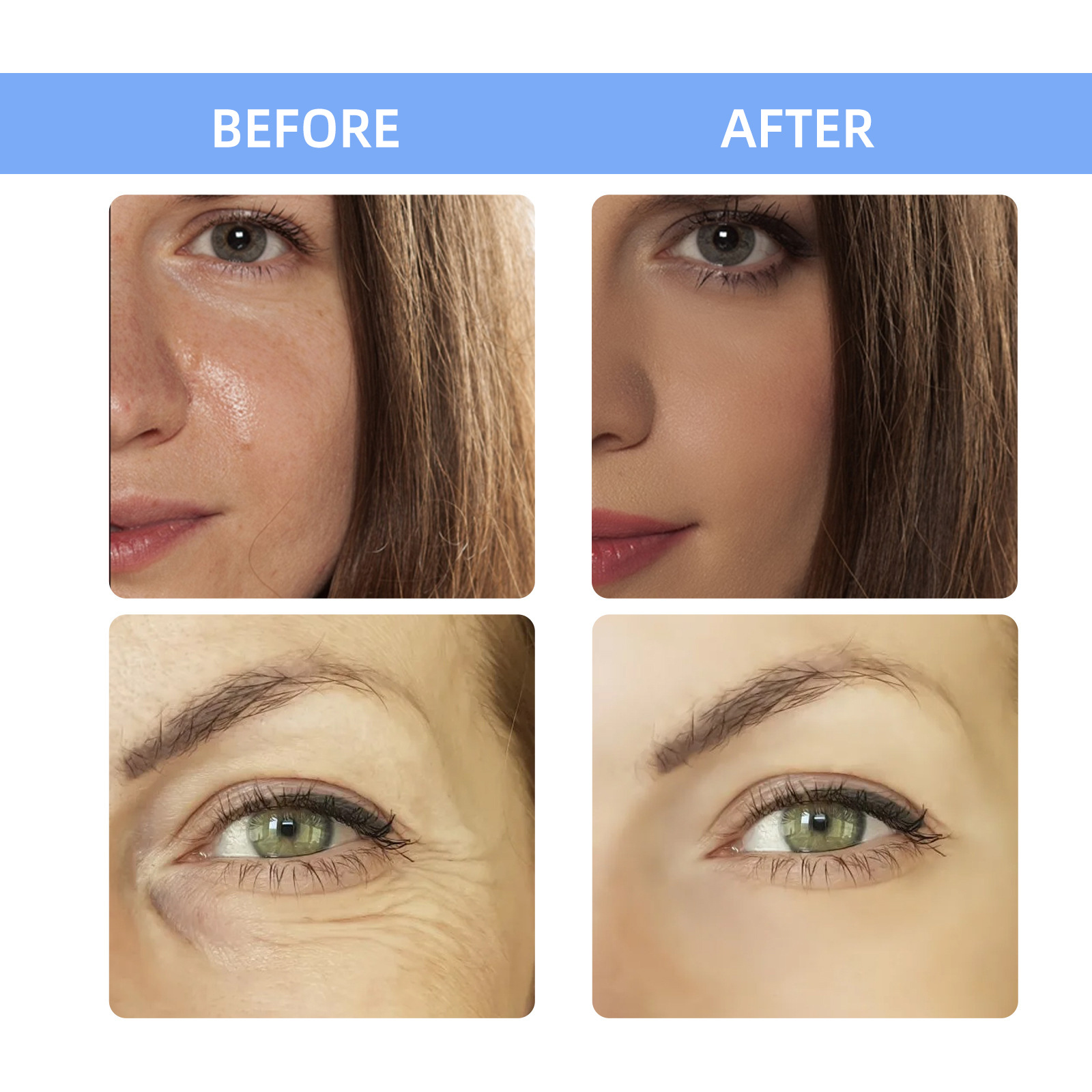 2ml*7pcs Hyaluronic acid Meso  - Hyaluronic Acid Facial Serum recension och pris