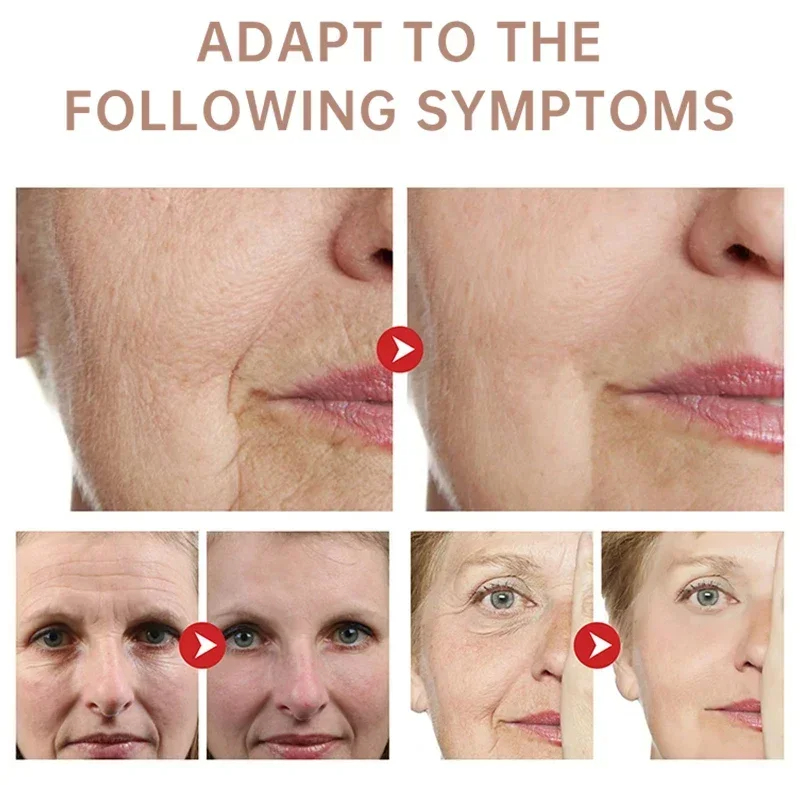 Remove Wrinkle Cream Retinol F - Retinol Anti Wrinkle Cream recension och pris