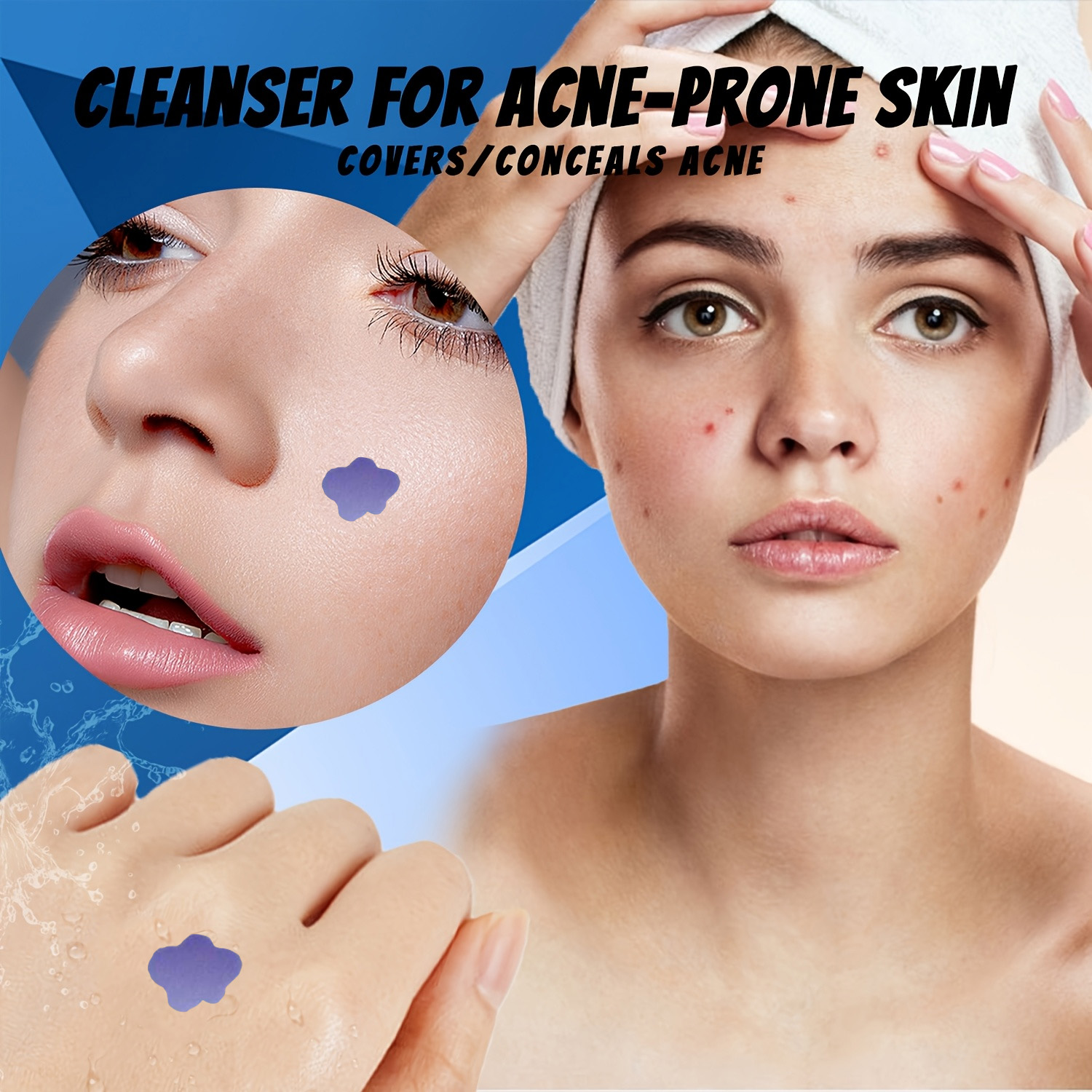 Microneedle Acne Pimple Patch  - Skincare recension och pris