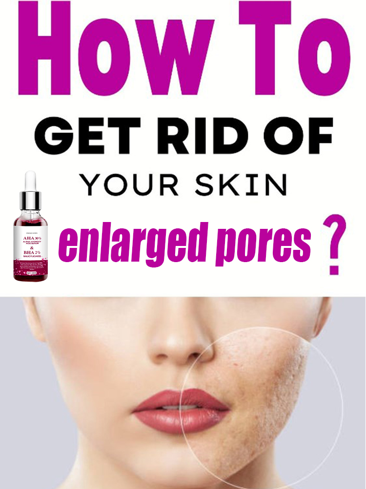 Shrink Pores Serum Salicylic F - Salicylic Acid Blackhead Remover recension och pris