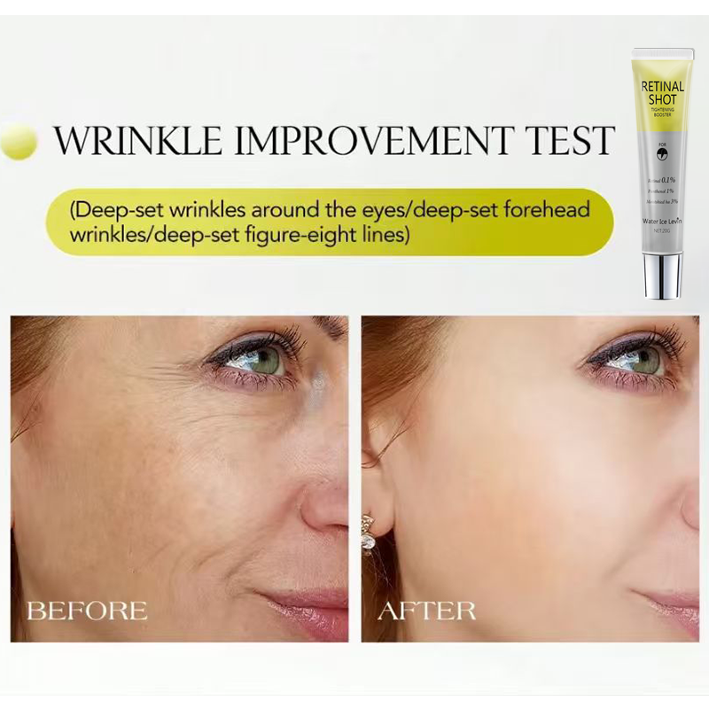 Retinal 0.1% Intensive Shot Pa - Retinol Anti Wrinkle Cream recension och pris