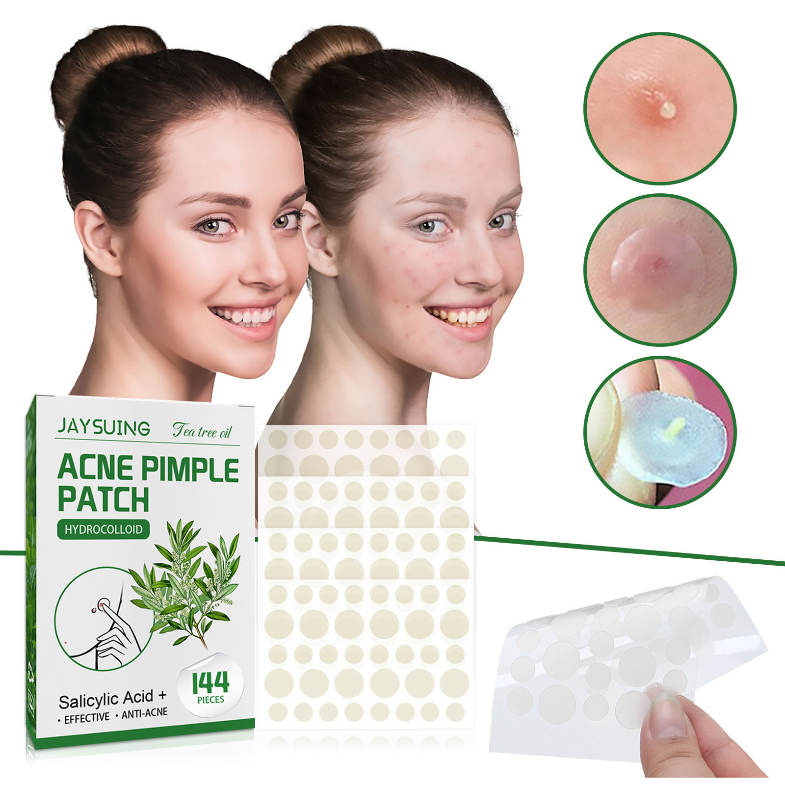 Hydrocolloid Acne Patches - Ab - Hydrocolloid Pimple Patch recension och pris