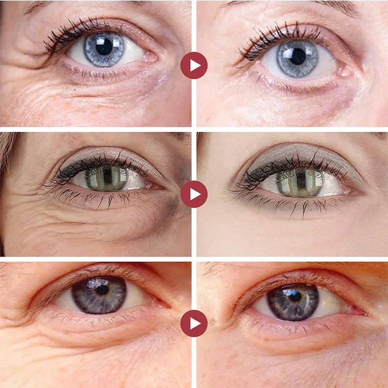 Wrinkle Remove Eyes Patches Fi - Collagen Under Eye Patches recension och pris